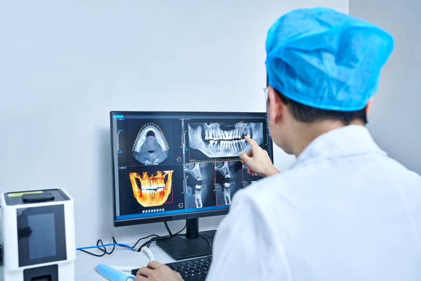 Best Knocked-Out Tooth (Avulsed Tooth) Treatment in Silver Lakes, CA